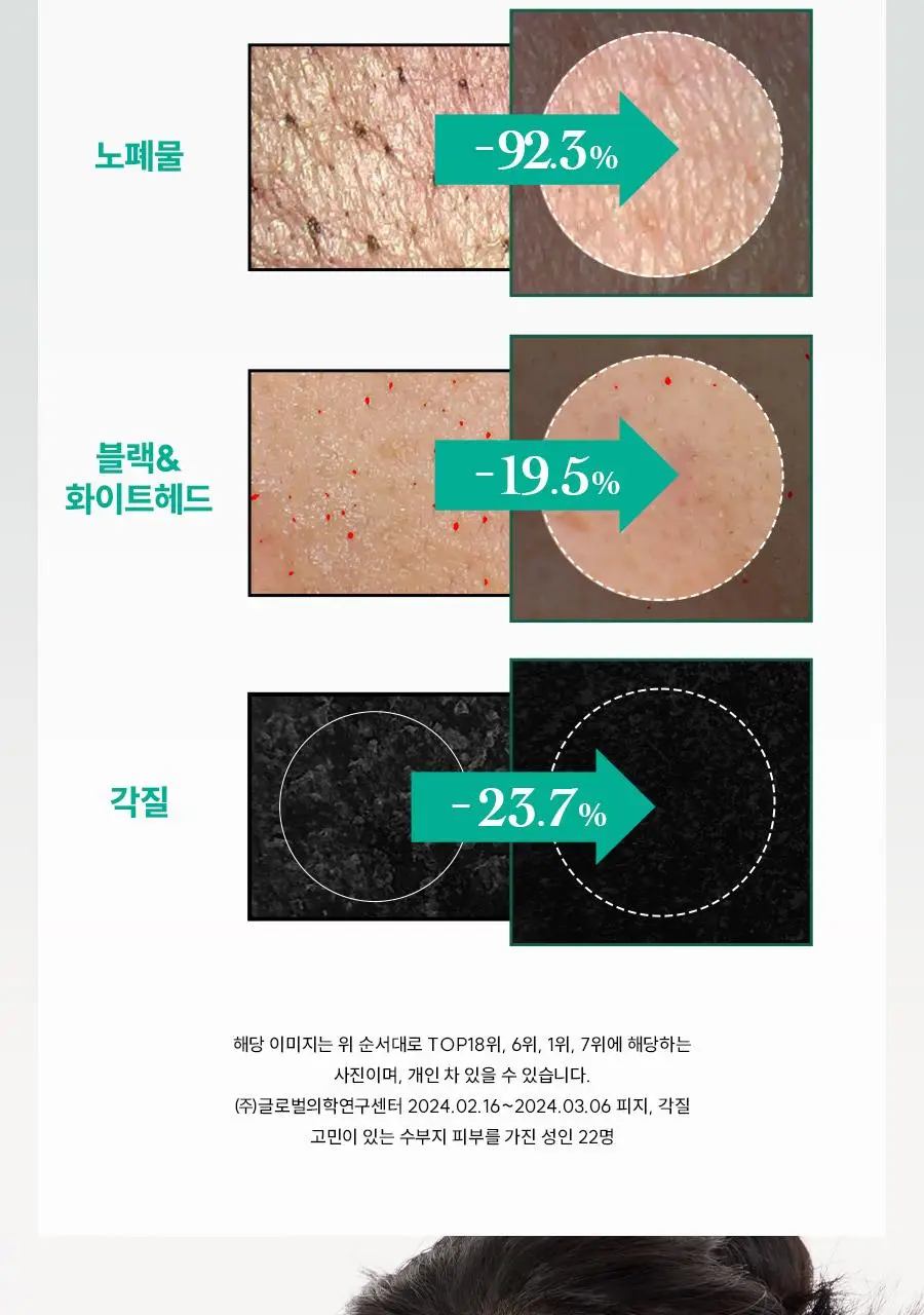 [쫀득팩폼] 한율 피지흡착 쑥떡팩폼 120ml 드롭드롭드롭 기획 (+15ml+카드지갑 키링) 상세페이지 29